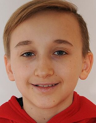Marko's Zahnspange vorher