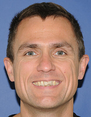Werner's Zahnspange vorher
