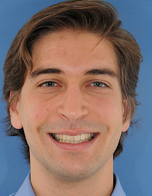 Andre's Zahnspange nachher