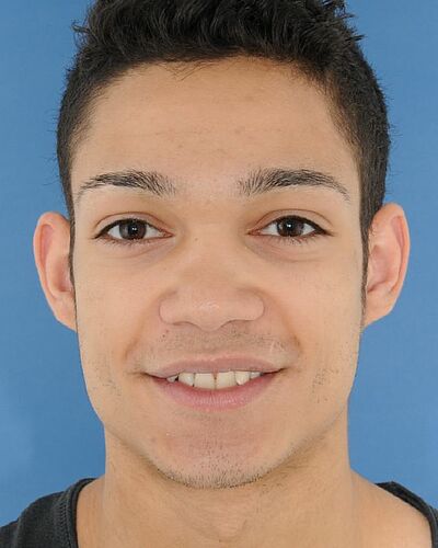 Marvin's Zahnspange vorher