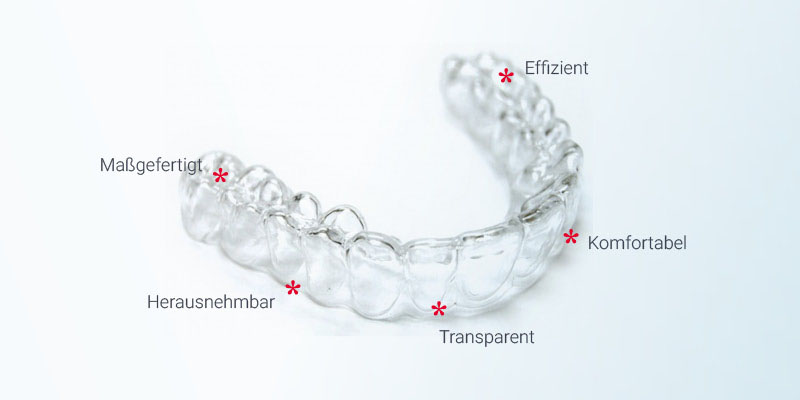 Ablauf einer Zahnregulierung mit Invisalign Zahnspange